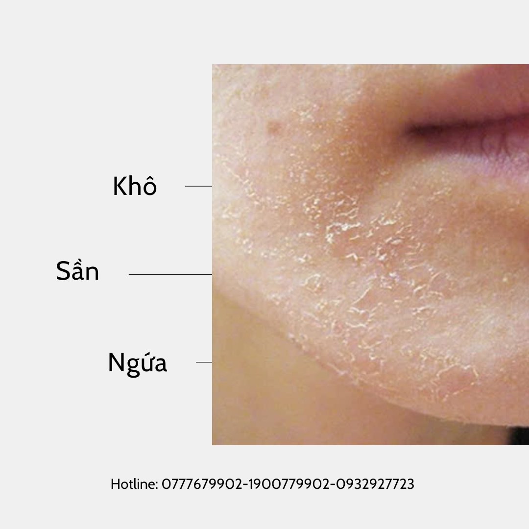 Chăm Sóc Da: Làm Sao Để Da Bạn Luôn Mịn Màng?