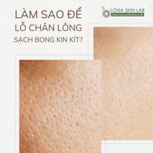 điều trị lỗ chân lông to