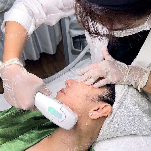 Thermage/HIFU – Công nghệ nâng cơ không xâm lấn ưu việt