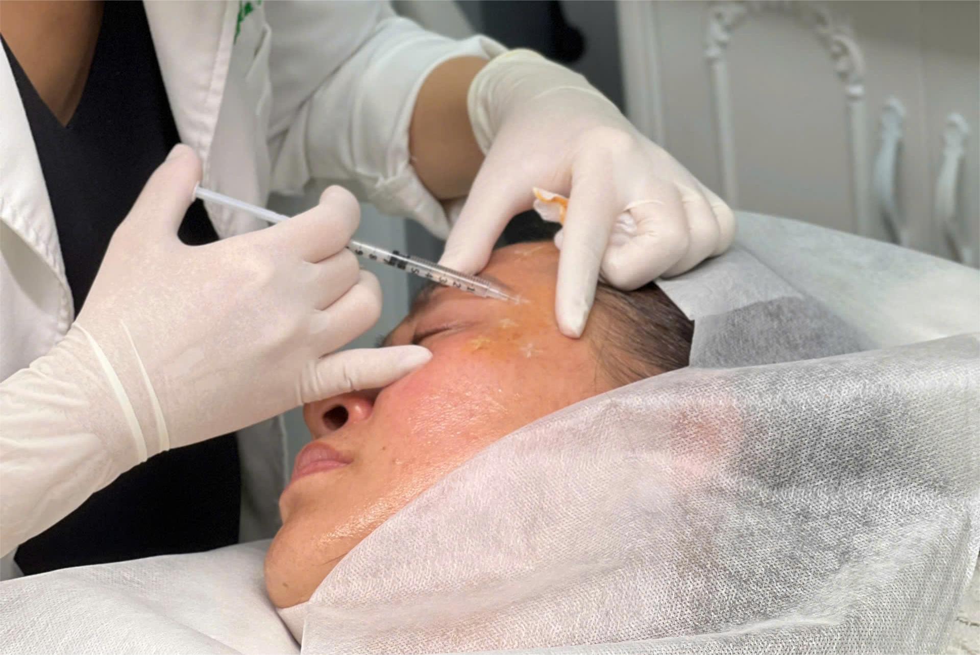 Phương pháp điều trị rụng tóc chuyên sâu kết hợp exosome trị rụng tóc và laser kích thích tóc được áp dụng nhằm tối ưu hóa quá trình phục hồi nang tóc và viêm nền, mang lại hiệu quả điều trị bền vững.