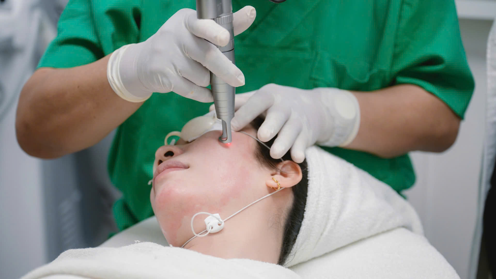 Phương pháp laser gold toning kết hợp hiệu quả gold toning, cho thấy toning là gì thông qua quá trình kích thích collagen và khuyến cáo chăm sóc da sau laser toning để tránh hiện tượng laser toning có bong da không.