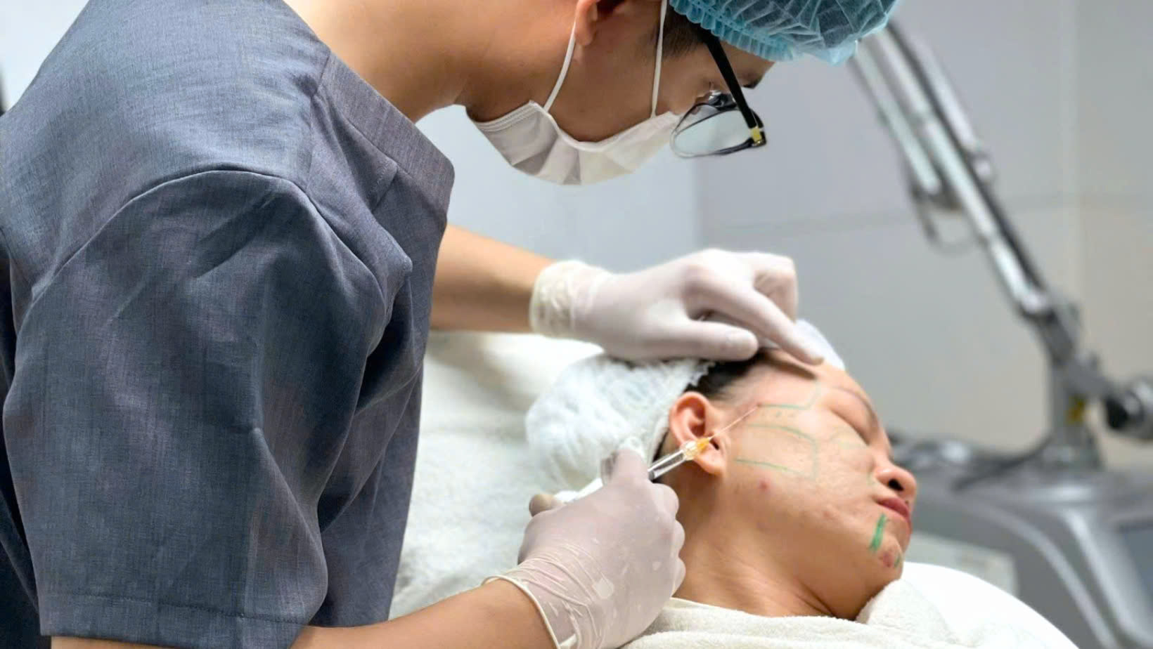 Hình ảnh chuyên sâu về liệu trình trị nếp nhăn trên vành môi, trung tâm cách trị nếp nhăn môi với kem chống nếp nhăn môi và hỗ trợ bài tập giảm nếp nhăn môi nhằm xác định rõ nguyên nhân nếp nhăn môi.