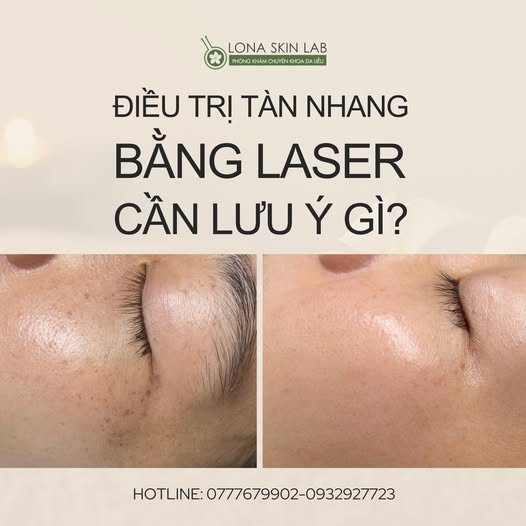 Điều trị bằng laser cần lưu ý những gì