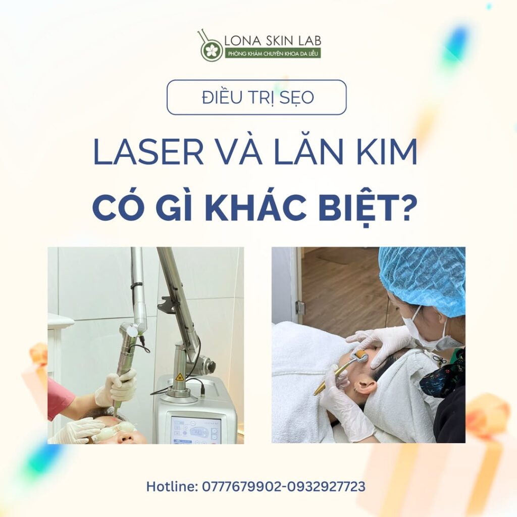 ĐIỀU TRỊ SẸO: SO SÁNH LASER VÀ LĂN KIM CÓ GÌ KHÁC BIỆT? 