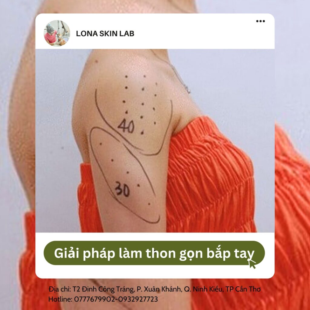 PHƯƠNG PHÁP TIÊM BOTOX THON GỌN BẮP TAY, VAI, BẮP CHÂN?