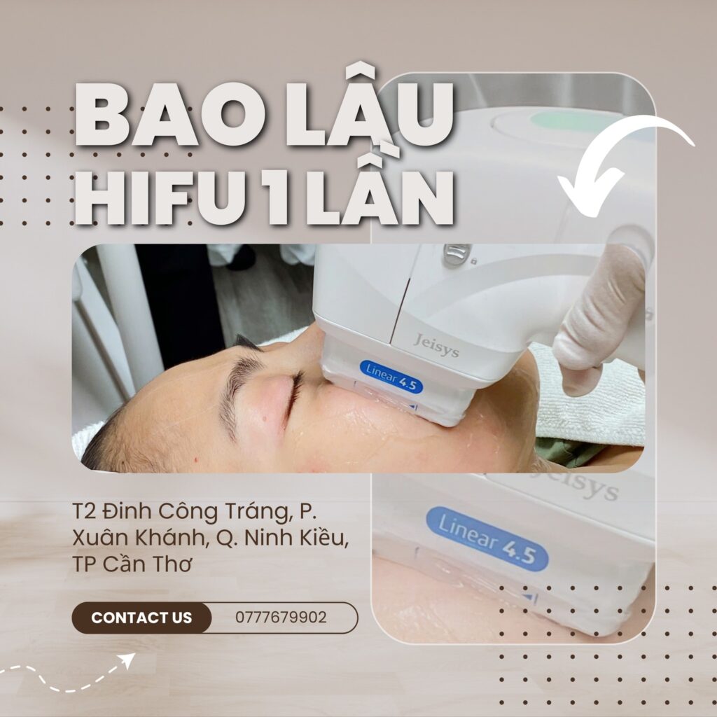 BAO LÂU THỰC HIỆN PHƯƠNG PHÁP HIFU MỘT LẦN?