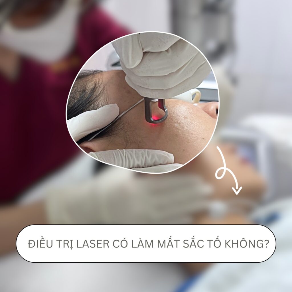  ĐIỀU TRỊ LASER CÓ LÀM MẤT SẮC TỐ DA KHÔNG?