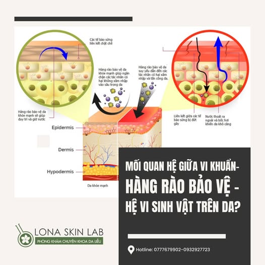 MỐI QUAN HỆ GIỮA VI KHUẨN - HÀNG RÀO BẢO VỆ DA - HỆ VI SINH TRÊN DA?