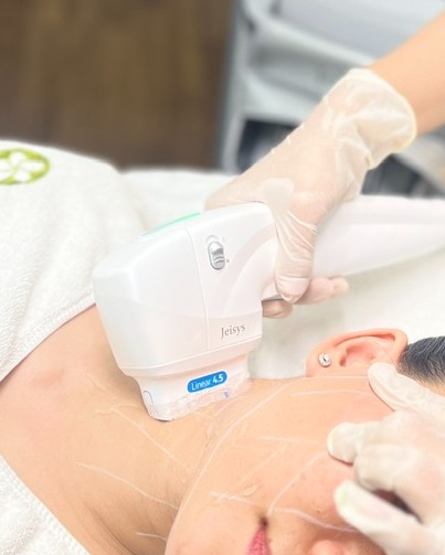 Hình ảnh minh họa trao đổi với chuyên gia về HIFU, nhấn mạnh việc trẻ hóa da và nâng cơ mặt an toàn trong liệu trình làm đẹp không xâm lấn.