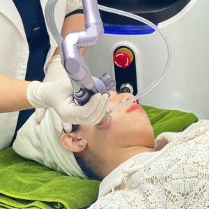 FRACTIONAL PEELING - BÍ QUYẾT THU NHỎ LỖ CHÂN LÔNG