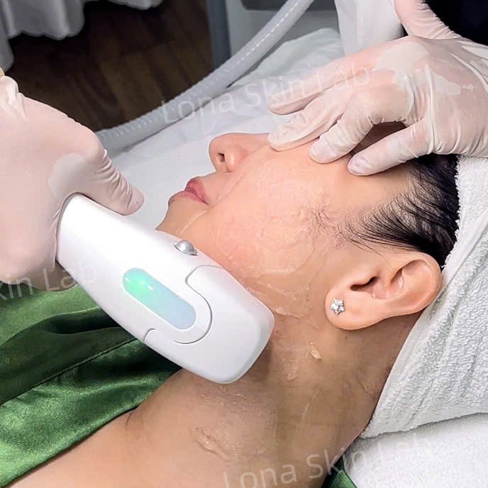 Sự khác biệt giữa HIFU và Thermage trong liệu trình trẻ hóa da không phẫu thuật và nâng cơ mặt