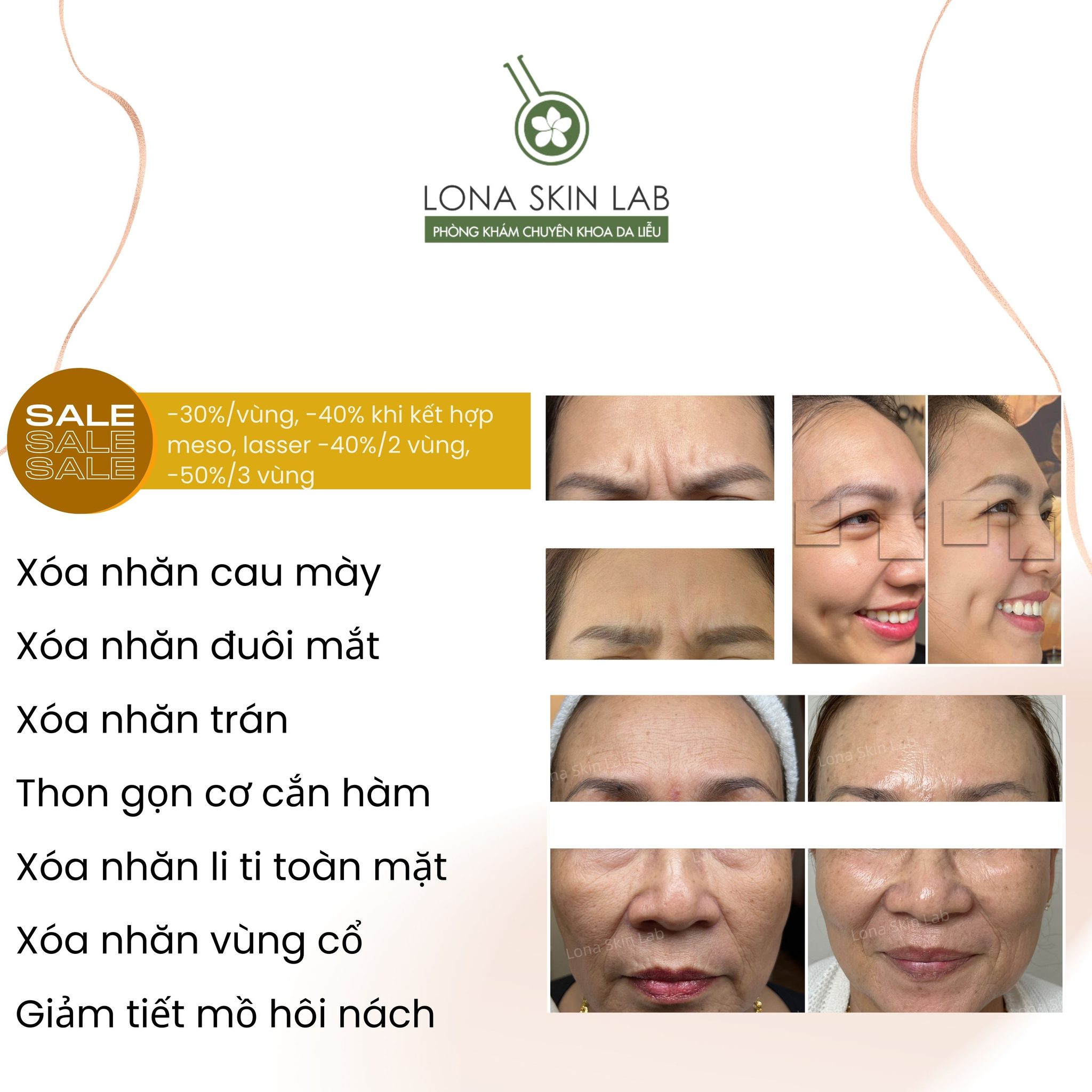 Bức hình thể hiện môi trường Lona Skin Lab khi thực hiện tiêm botox thon gọn hàm, ứng dụng công nghệ HIFU thon gọn hàm và phương pháp giảm mỡ mặt không phẫu thuật nhằm kiến tạo đường viền thon gọn hàm sắc nét.