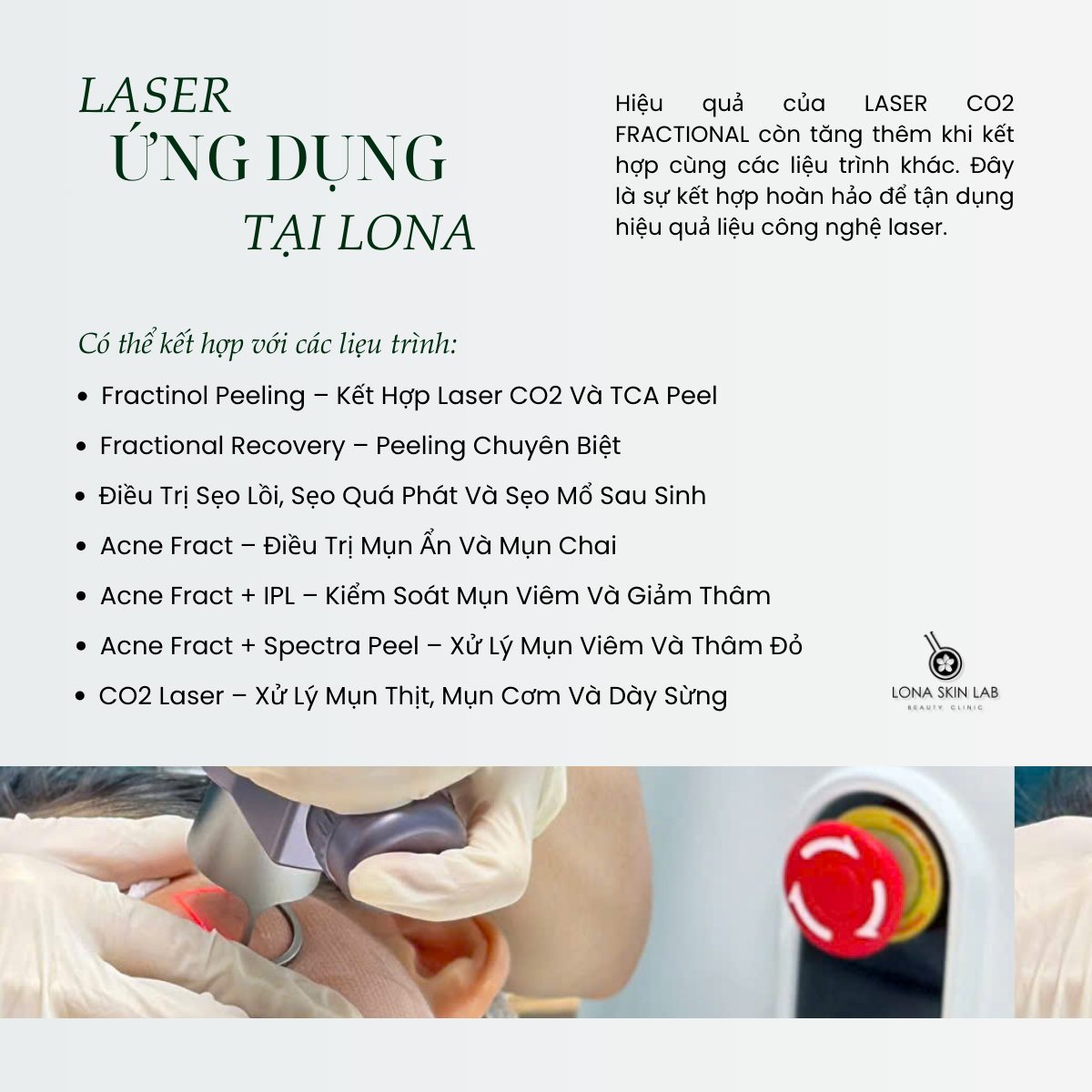 Tái tạo da bằng Laser CO2 Fractional không chỉ là cách điều trị sẹo lồi mà còn là phương pháp trị sẹo lồi tiên tiến dành cho sẹo lồi cạnh hàm, hỗ trợ laser điều trị sẹo lồi hiệu quả.