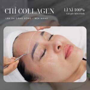 căng chỉ da mặt collagen lona skin lab