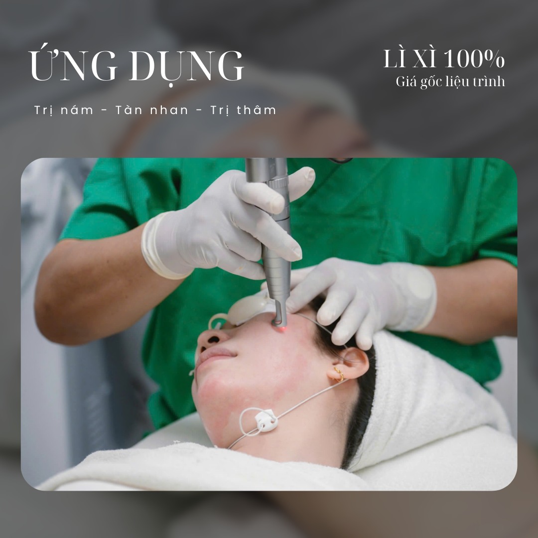 Ứng dụng công nghệ laser Carbon trong cách điều trị sẹo lồi, phương pháp trị sẹo lồi tiên tiến cho sẹo lồi vùng cạnh hàm, theo xu hướng laser điều trị sẹo lồi hiện đại.
