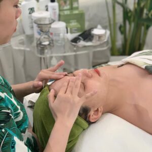 Điều trị sẹo lõm và sẹo lồi tại Lona Skin Lab