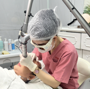 Công nghệ Laser hỗ trợ cách điều trị sẹo đáy nhọn an toàn