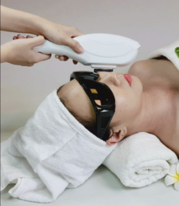 Ưu Điểm Của Triệt Lông Mặt Tại Loan Skin Lab