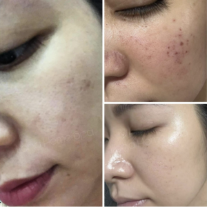 Thay đổi khi uống collagen