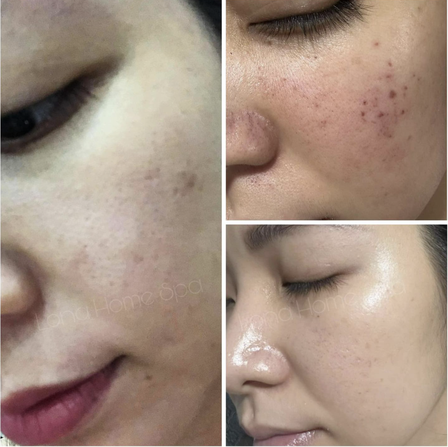 Việc uống collagen đúng cách giúp cải thiện hiệu quả collagen trên da và tận hưởng lợi ích collagen từ sản phẩm tự nhiên.