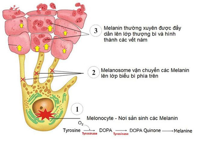 Ức chế phản ứng tạo melanin ngăn người tăng sắc tố da