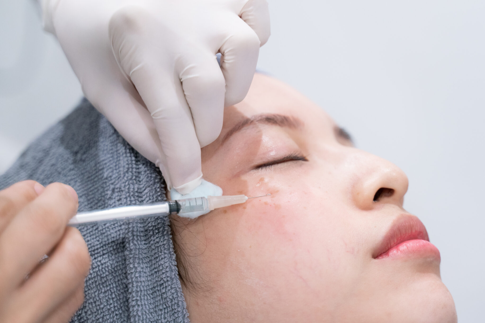Liệu trình Tiêm BAP tại Cần Thơ với Profilo và Jalupro