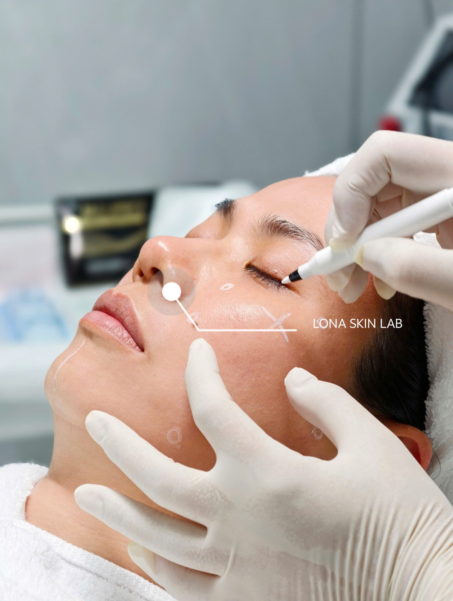 Quy trình tiêm BAP Rejuran uy tín Cần Thơ tại Lona Skin Lab