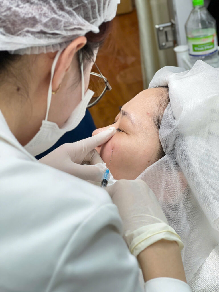 Phân bố mô mỡ nông và sâu, liên quan đến tuổi 35 và lão hóa