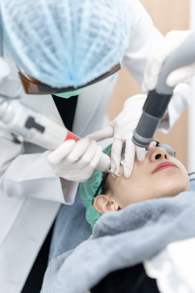 Hình ảnh Laser Fractional CO2 minh họa quy trình điều trị sẹo rỗ, trẻ hóa da và kích thích tái tạo da tự nhiên.