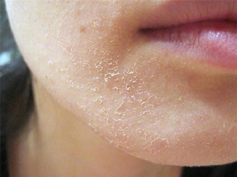 sản phẩm chăm sóc da, chất lượng da, glow skin
