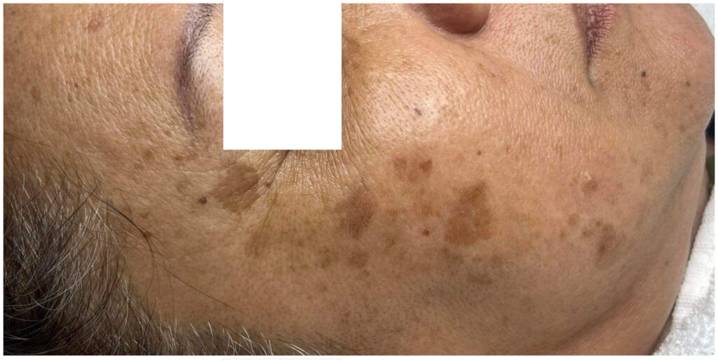 chất lượng da, glow skin, chăm sóc da