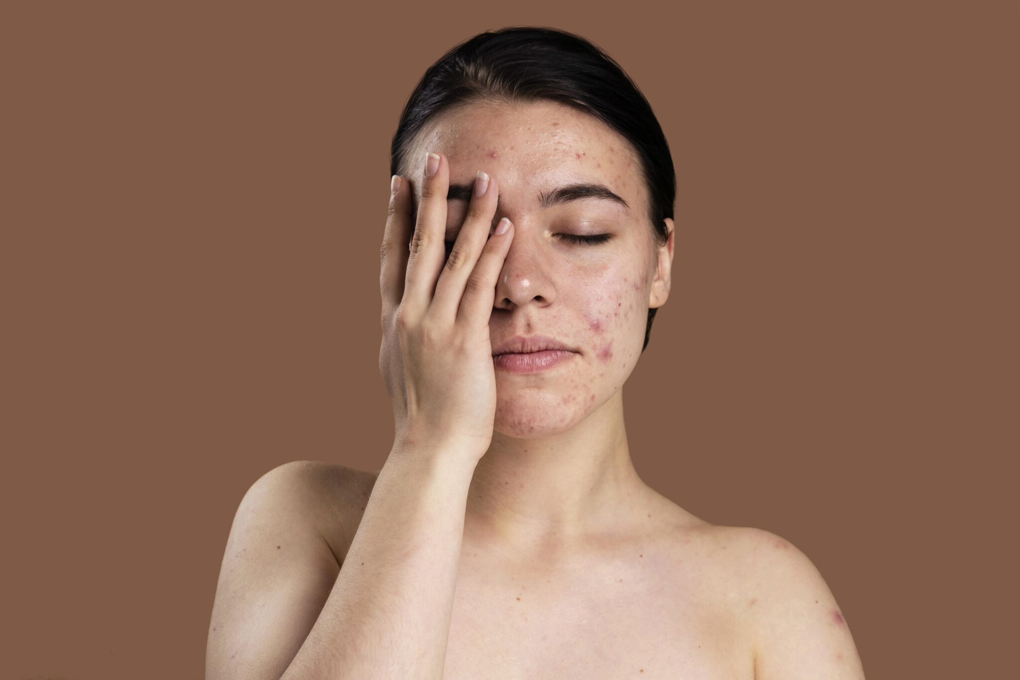 Quá trình nghiên cứu lâm sàng cho thấy mụn trứng cá đỏ thường có triệu chứng mụn trứng cá đỏ và viêm mạnh, tạo nên sự khác biệt giữa mụn trứng cá đỏ và mụn trứng cá thường, trong khi nguyên nhân mụn trứng cá đỏ được cho là do các yếu tố nội sinh và môi trường.
