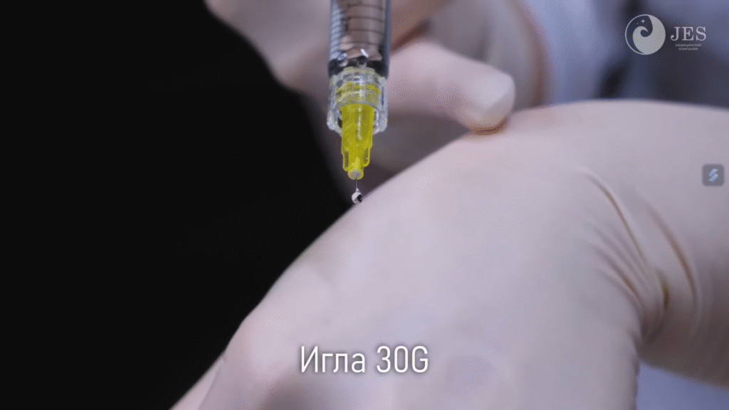Karisma ECM tái tạo nền da: Quy trình tiêm qua đầu kim tinh vi kích thích ECM và tái tạo nền da trẻ trung.