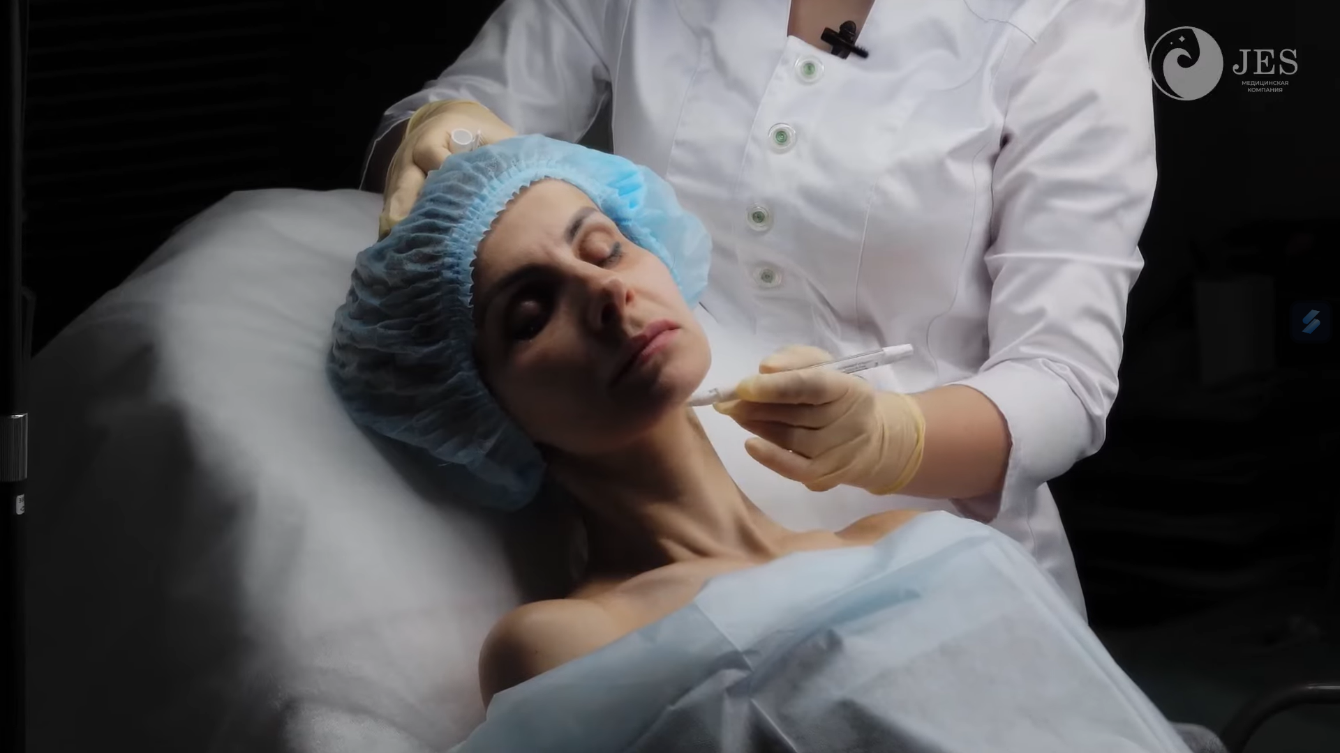 Ảnh minh họa liệu trình Karisma kết hợp filler