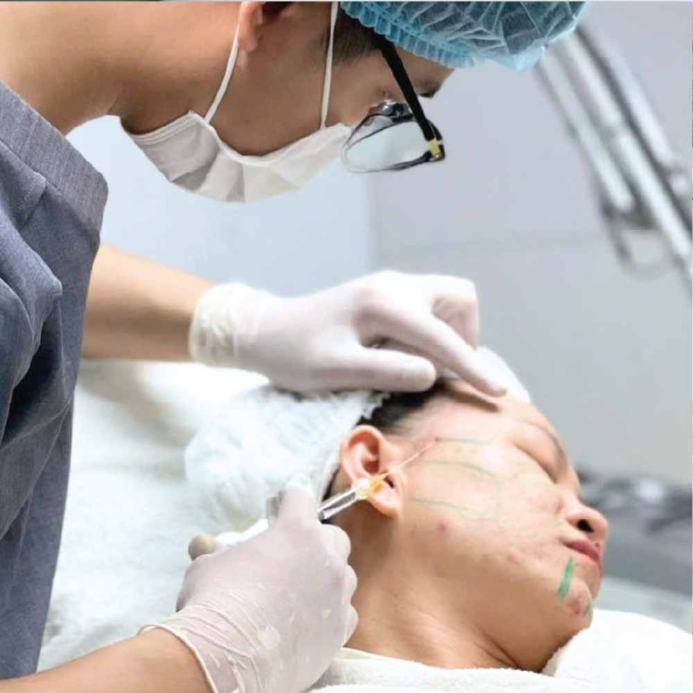 Ảnh minh họa liệu trình Karisma kết hợp filler