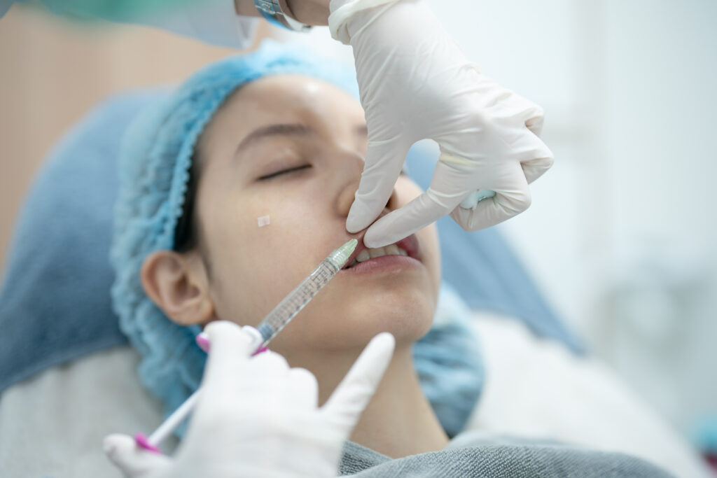 Hình minh họa quy trình Tiêm Filler an toàn Cần Thơ tại Lona Skin Lab