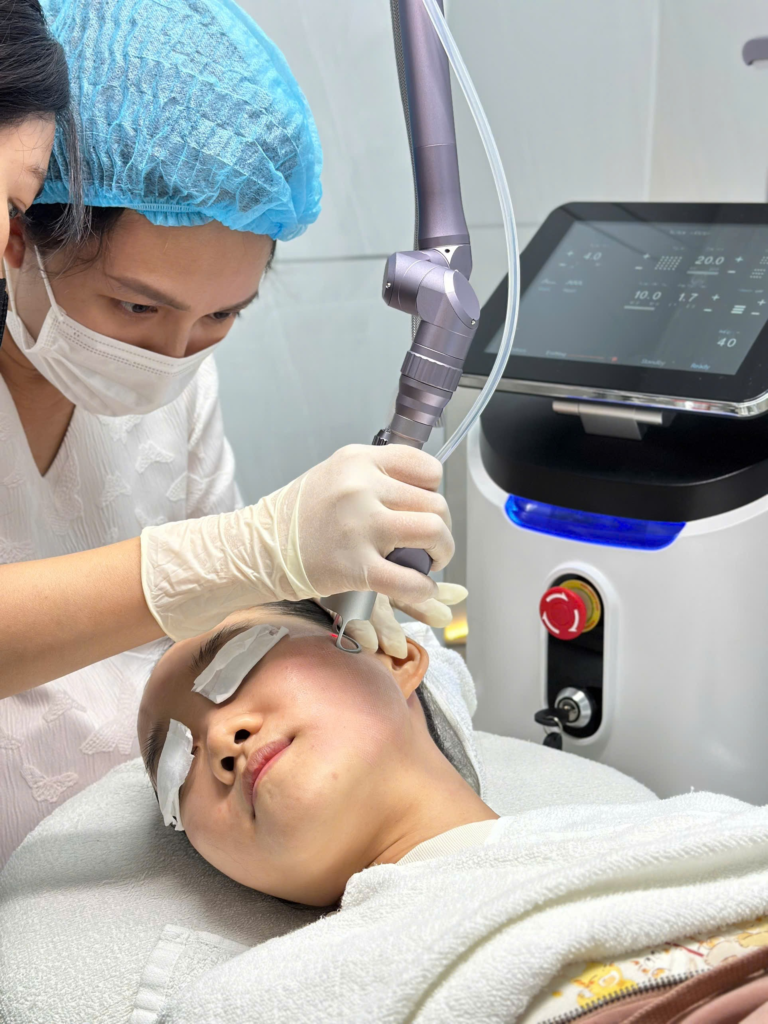 Điều Trị Sẹo Rỗ tại Cần Thơ - Quy trình với Công nghệ cao không kim