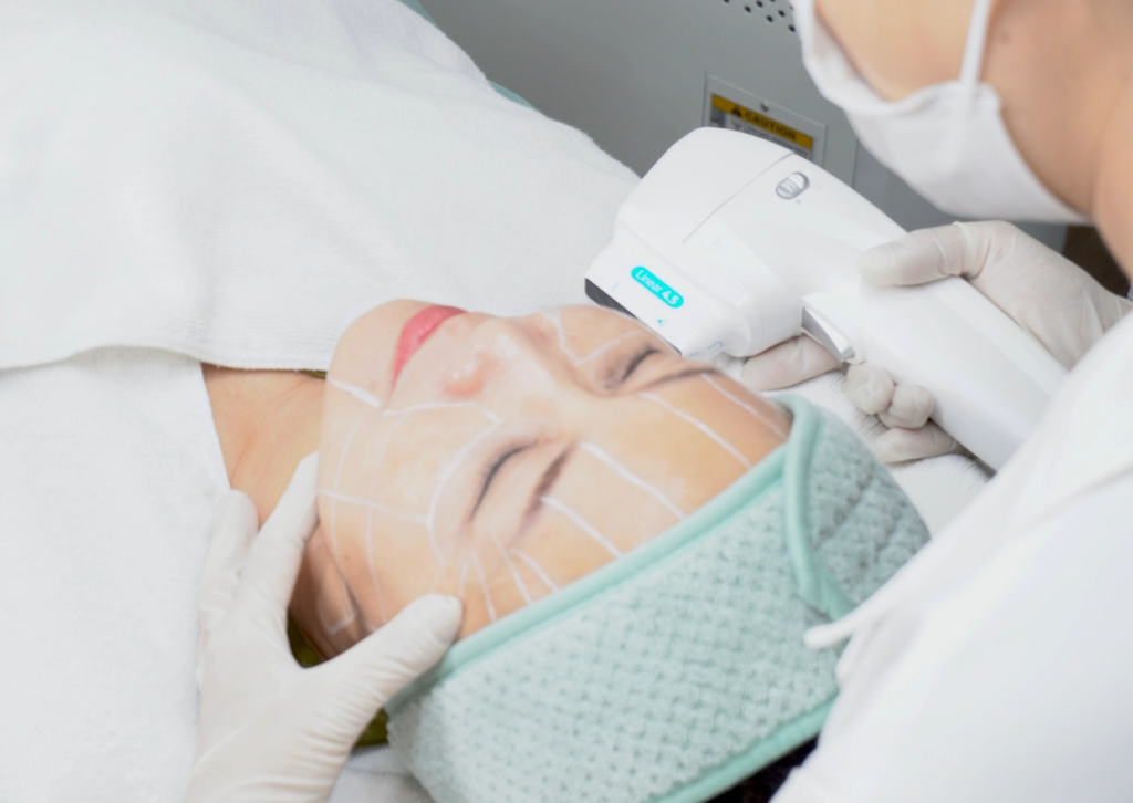 Hình ảnh quy trình điều trị HIFU Cần Thơ