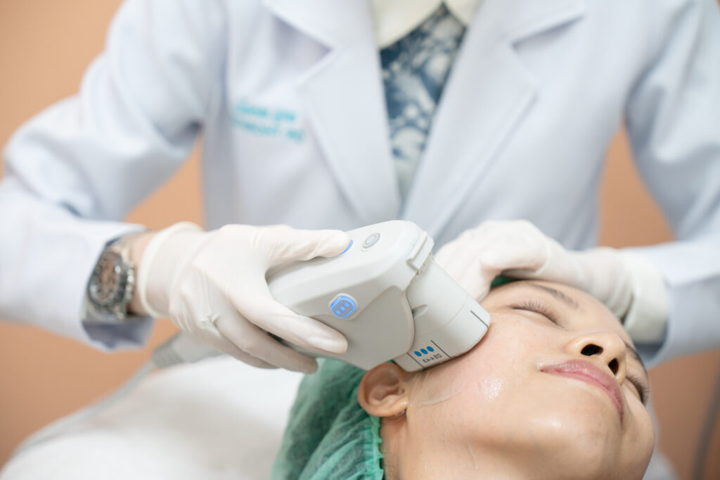Hình ảnh HIFU – công nghệ xóa nhăn và thẩm mỹ 2025 với hiệu quả an toàn