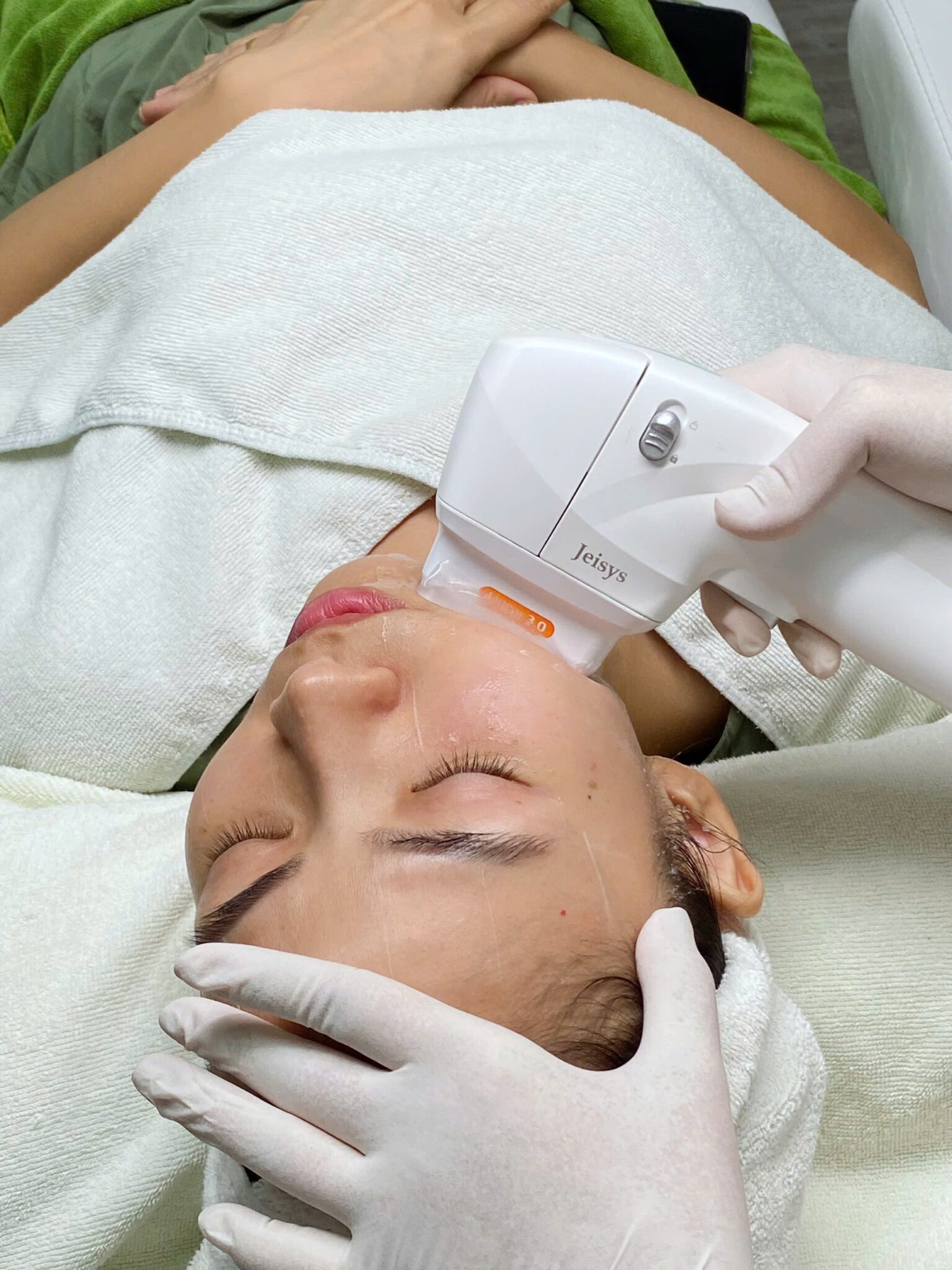 Hình minh họa quy trình HIFU và hiệu quả HIFU trong điều trị