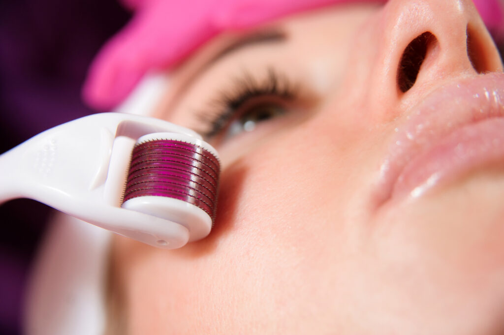 Quá trình điều trị lão hóa da toàn mặt theo phương pháp điều trị lão hóa chuyên sâu của Lona Skin Lab