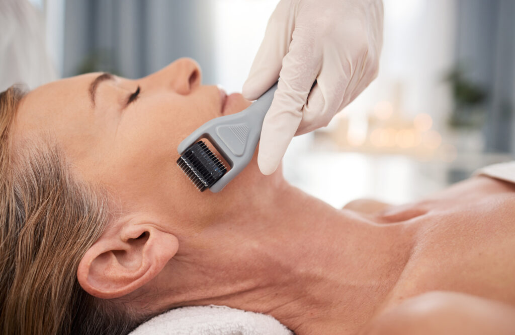 Hình ảnh mô tả sẹo hỗn hợp và quá trình điều trị sẹo hỗn hợp tại Lona Skin Lab