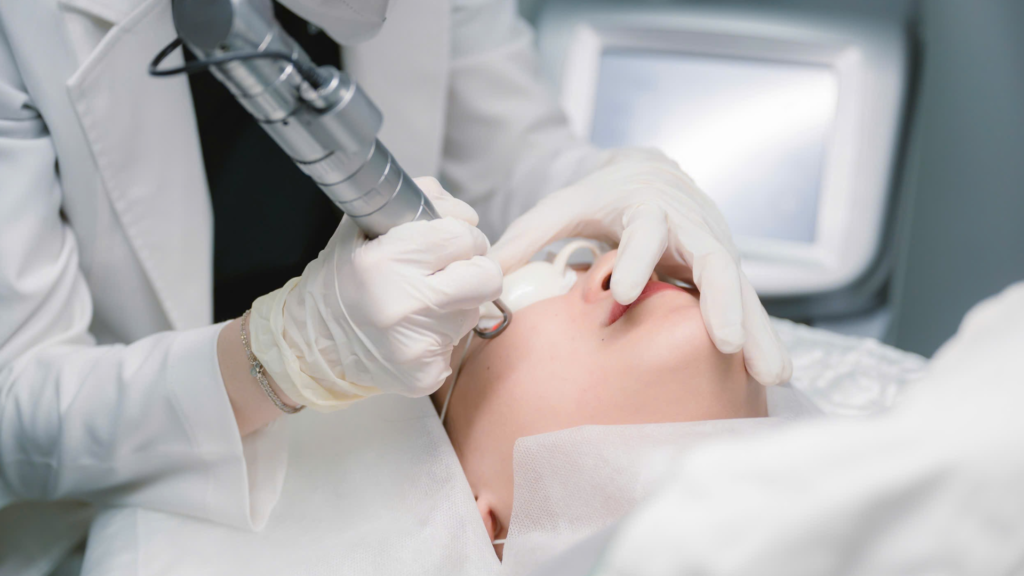 Hình ảnh này cho thấy quy trình resurfacing laser tiên tiến, kết hợp resurfacing laser chuyên sâu cùng khả năng tái tạo da bằng laser hiện đại; phương pháp trẻ hóa da bằng laser được áp dụng đồng đều, hỗ trợ điều trị sẹo bằng laser và thu nhỏ lỗ chân lông bằng laser để đạt kết quả tối ưu cho làn da.