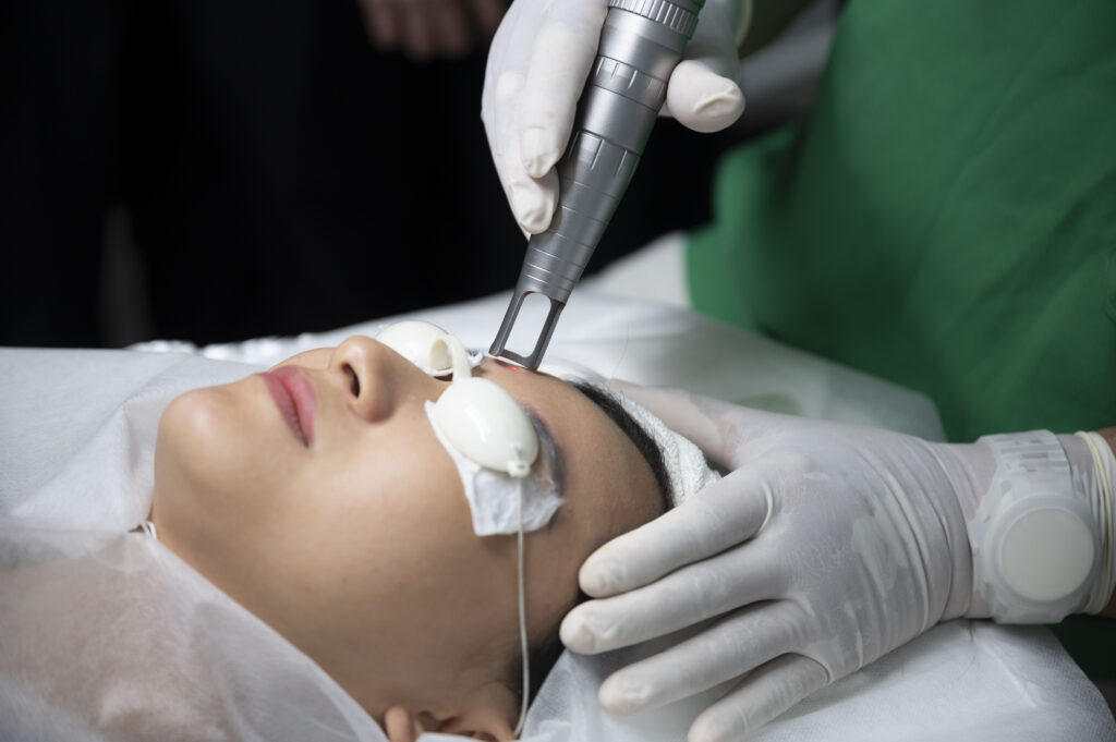 Minh họa qua hình ảnh này, kỹ thuật resurfacing laser hiện đại cùng resurfacing laser chuyên sâu giúp tái tạo da bằng laser nhanh chóng, mang lại hiệu quả trẻ hóa da bằng laser rõ rệt, đồng thời điều trị sẹo bằng laser và thu nhỏ lỗ chân lông bằng laser một cách an toàn.