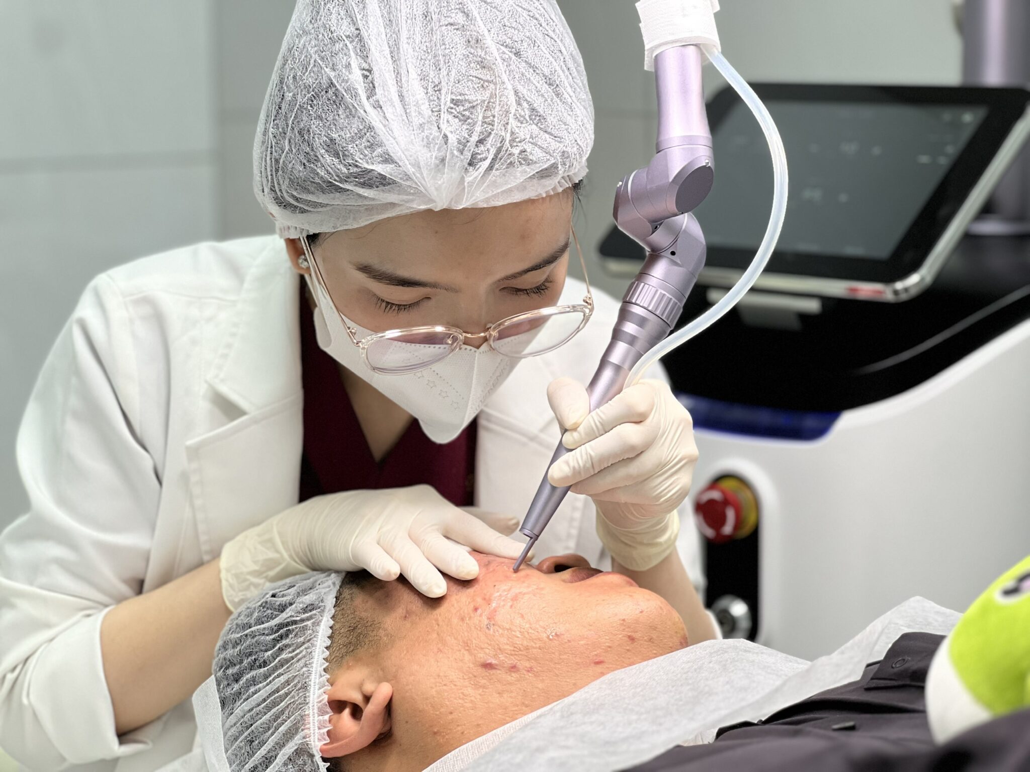 Điều Trị Sẹo Rỗ tại Cần Thơ - Phương pháp Laser Fractional CO2 tại Lona Skin Lab