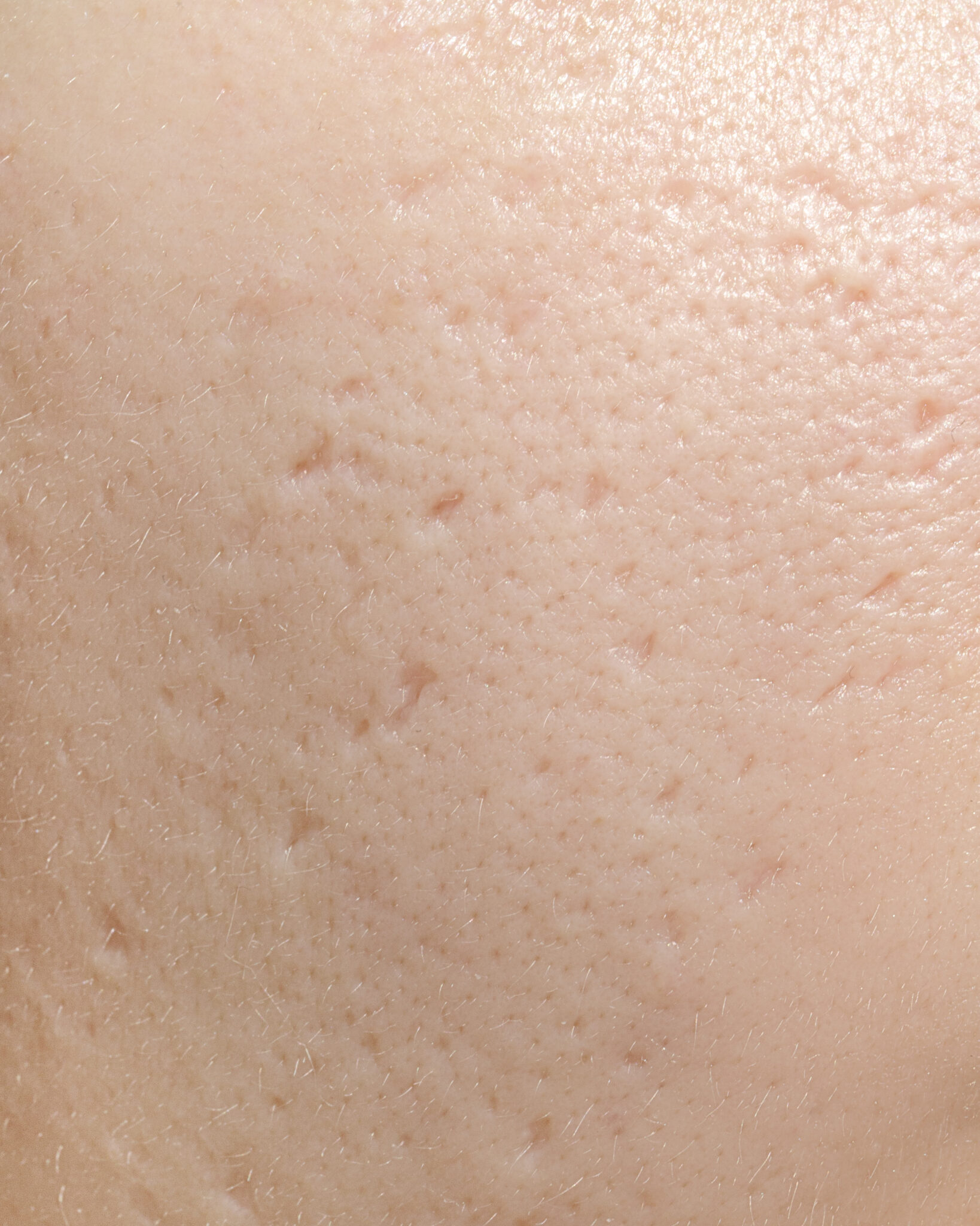 Thu nhỏ lỗ chân lông, lỗ chân lông, thu nhỏ lỗ chân lông, skincare, lona.vn, chăm sóc da