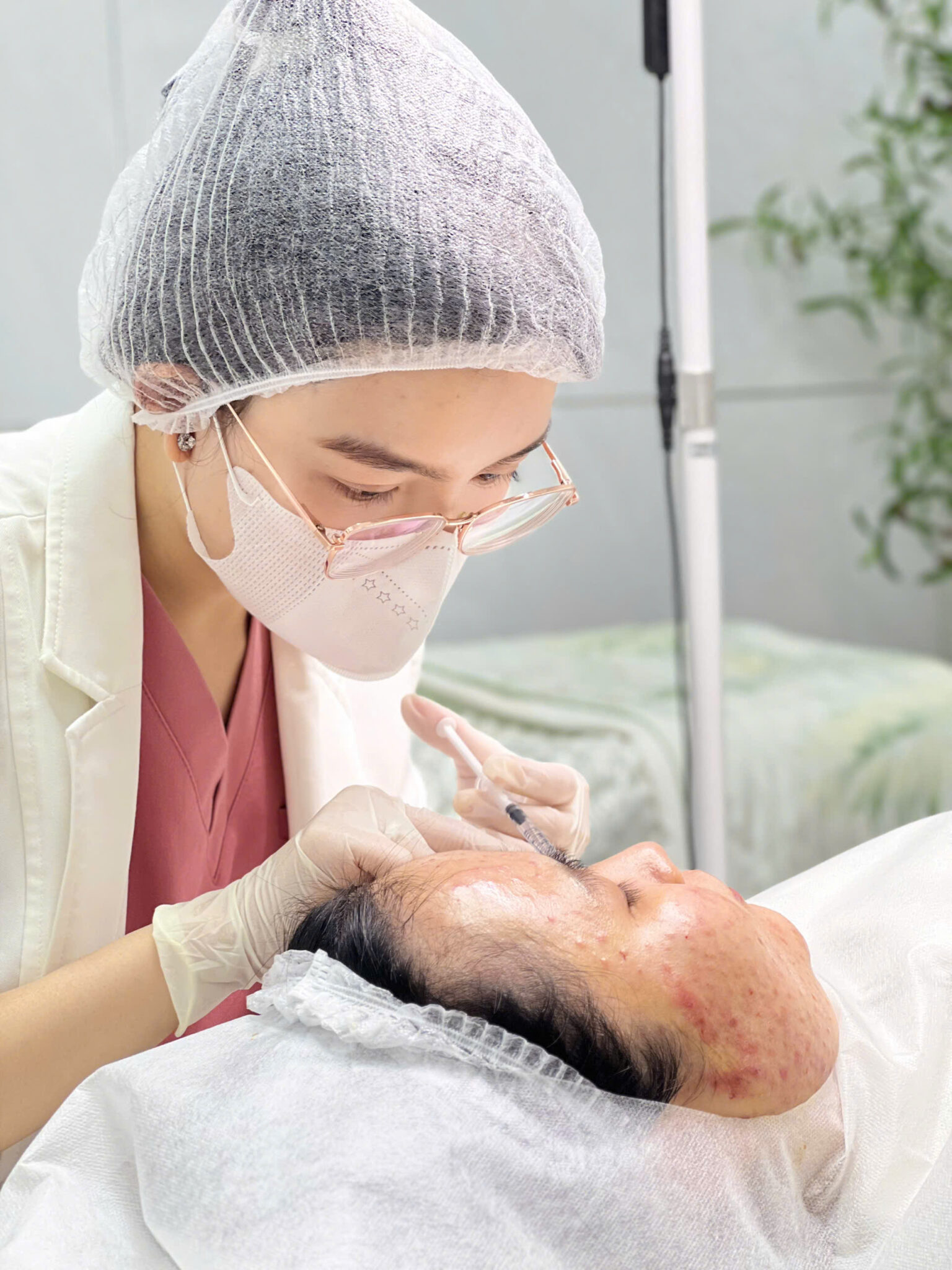 Quy trình Liệu pháp Meso Exosome trị mụn tại Cần Thơ kết hợp Exosome giảm viêm mụn, mang lại hiệu quả chăm sóc da toàn diện.