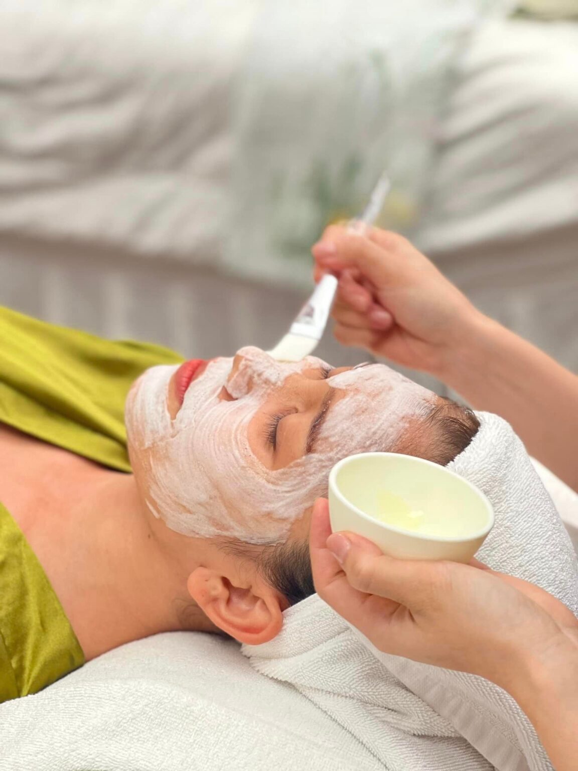 Điều trị giãn mao mạch tại Cần Thơ - Phương pháp điều trị