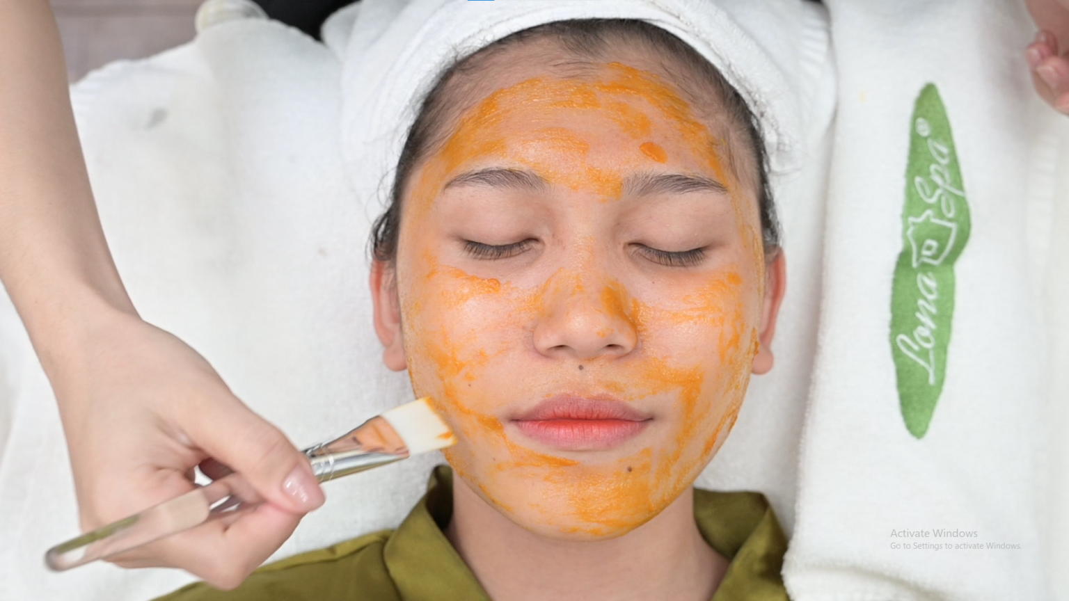 Ảnh thể hiện phương pháp căng da mặt bằng chỉ không tiêm tiên tiến, kết hợp kỹ thuật căng da mặt không phẫu thuật và trẻ hóa da mặt với chỉ sinh học đạt hiệu quả cao.