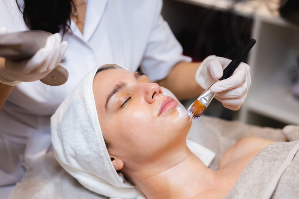 Hình ảnh minh họa peel da chuẩn y khoa Cần Thơ tại Lona Skin Lab